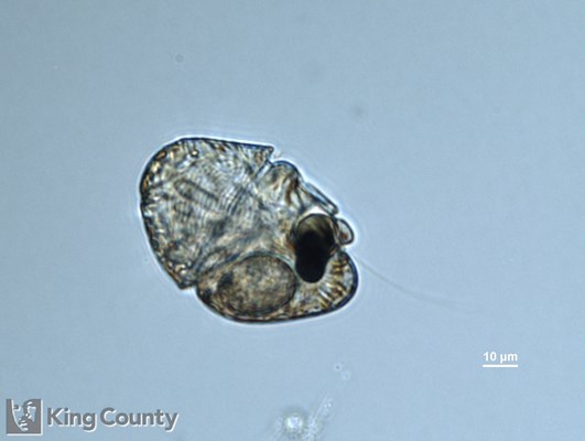 Photo of Nematodinium armatum